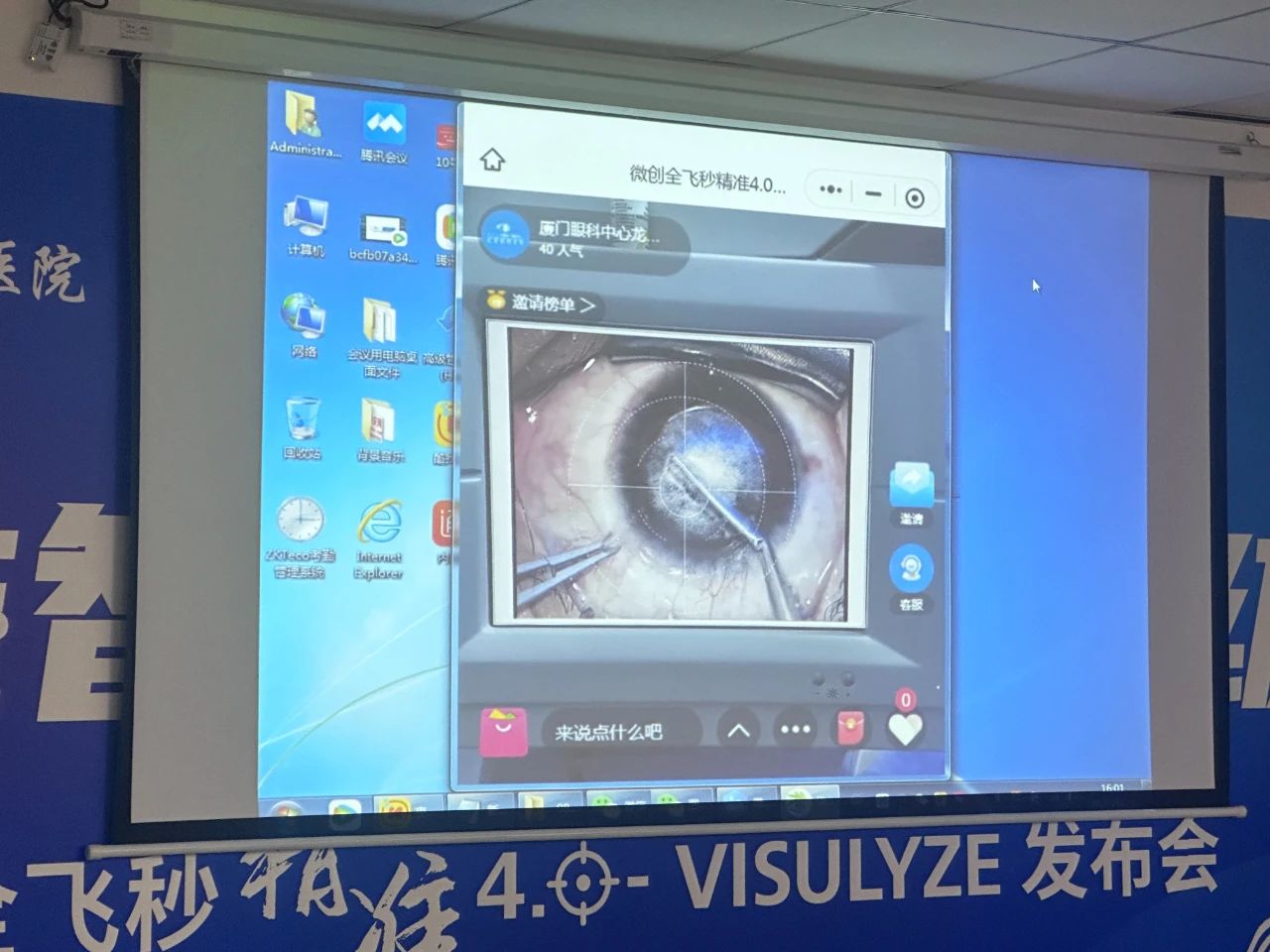 （全飞秒4.0手术过程现场直播）
