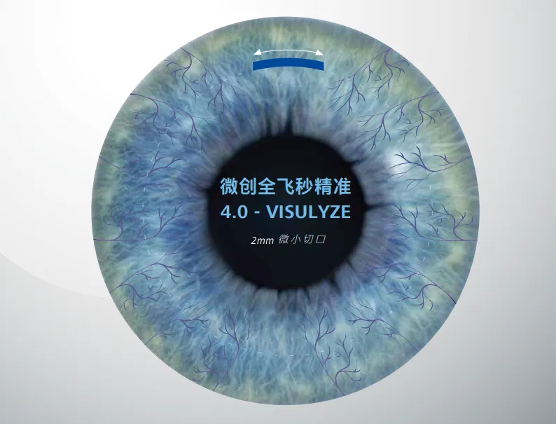 微创全飞秒精准4.0