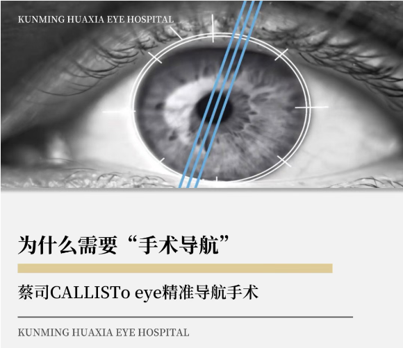 精准赋能，点睛未来 | 蔡司CALLISTO Eye精准导航手术强势来袭