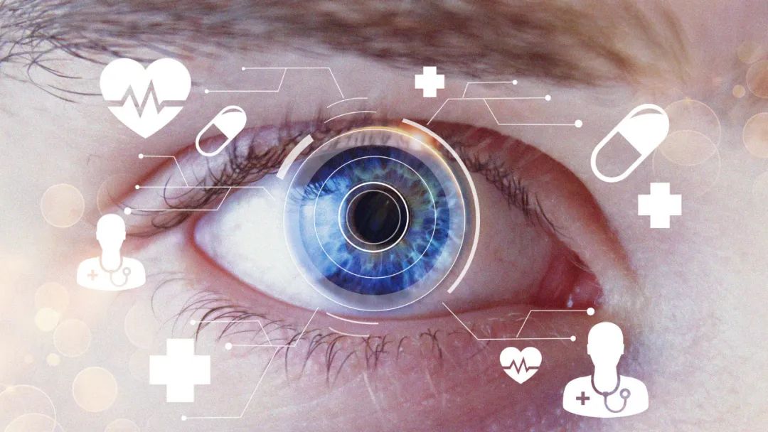 眼健康