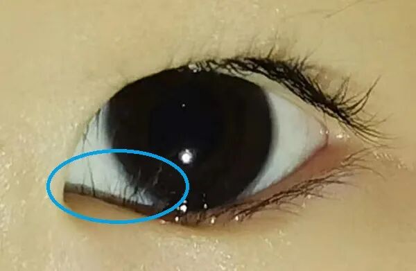 合肥华厦名人眼科|孩子总爱揉眼睛不一定是犯困，还可能是因为它！