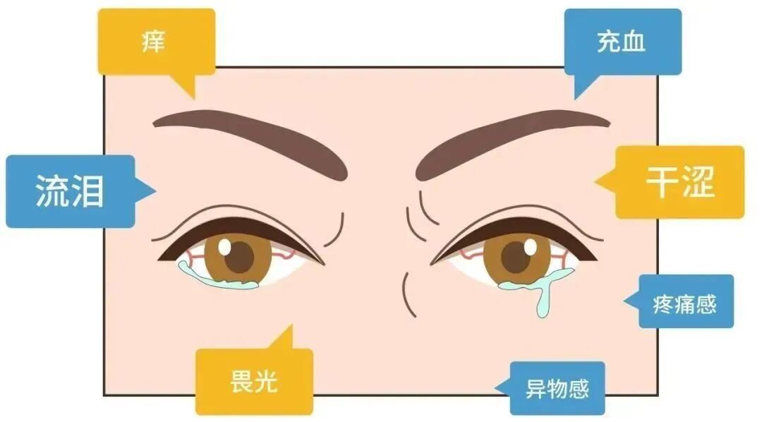 你的眼睛“缺水”吗