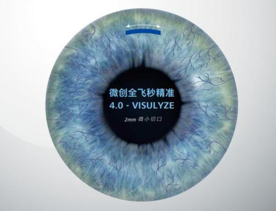 全飞秒精准4.0VS全飞秒3.0：新一代技术到底强在哪？