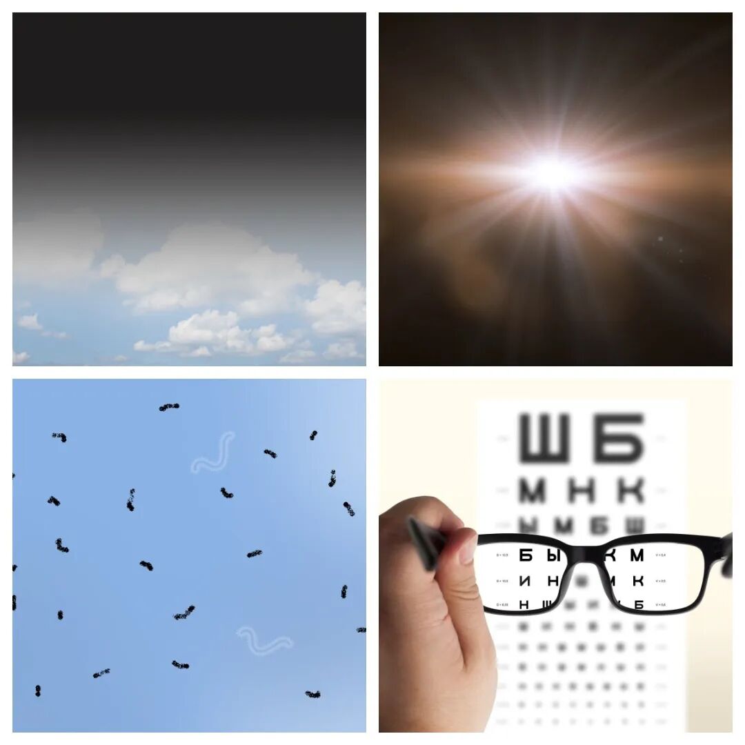 视网膜脱离的视物症状