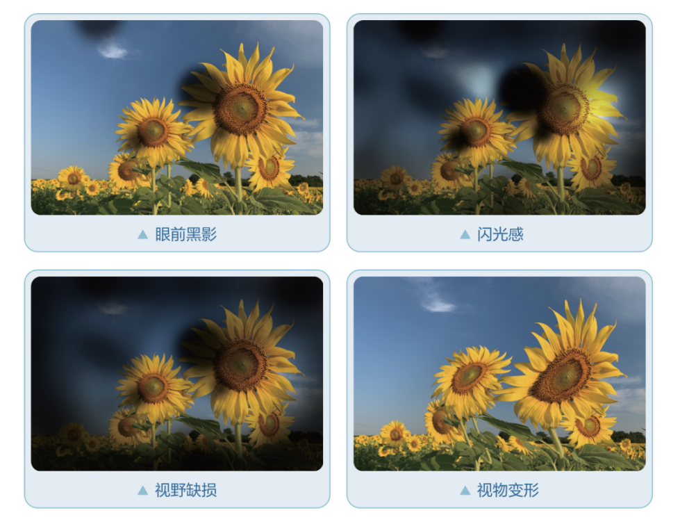 近视的连带整张