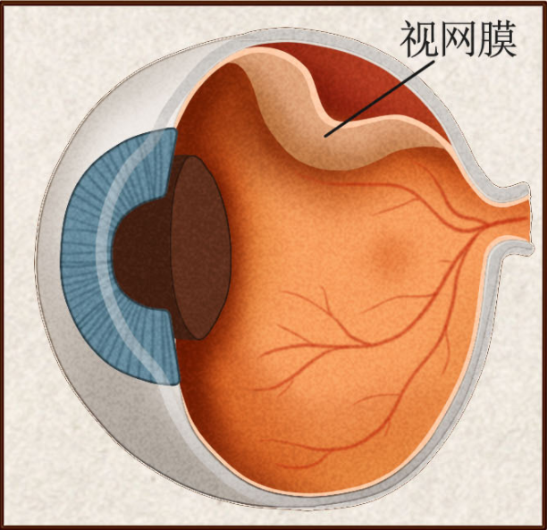 郑州华厦视光眼科|眼前黑影飘？小心你的"底片"在脱落！这些信号千万别忽略