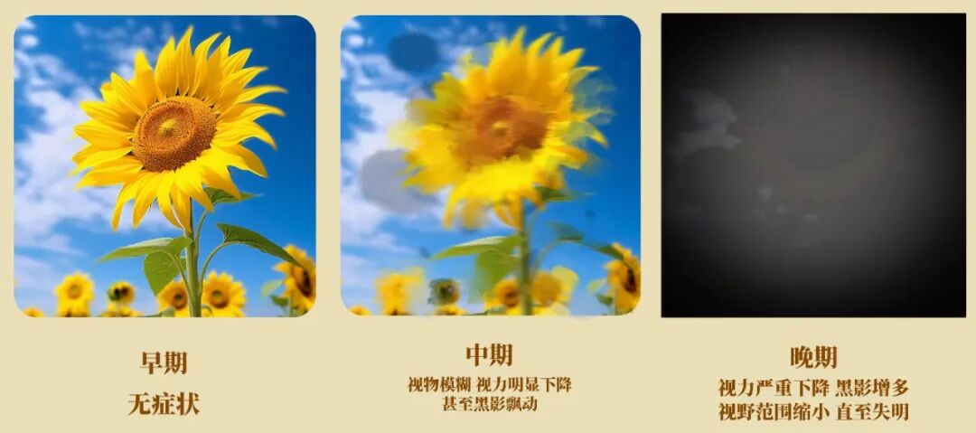 宜昌华厦眼科糖尿病眼病关爱月 | 警惕“糖网”偷走视力！糖尿病患者如何护眼？