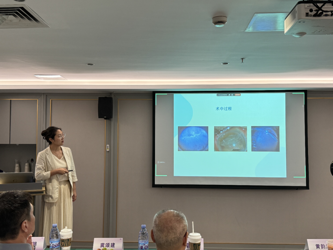 西安交通大学第二附属医院的田澍蔚医生以孔源性视网膜脱离玻切术后持续视网膜下液