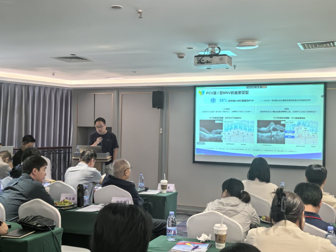 来自厦门眼科中心的张谋鑫医生围绕息肉状脉络膜血管病变（PCV）展开分享